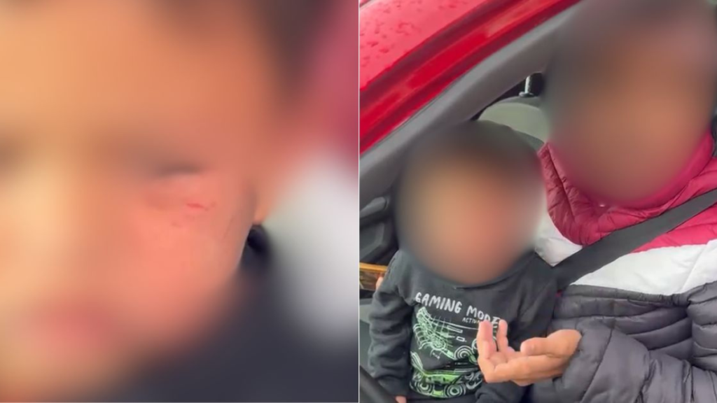 menino agredido na Praia do Rosa
